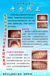 牙齿矫正海报