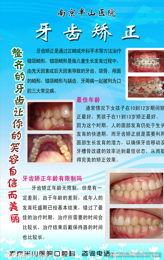 牙齿矫正海报