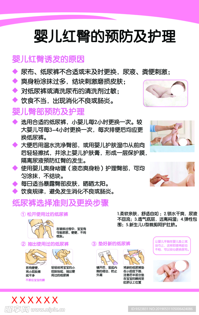 婴儿红臀预防及护理