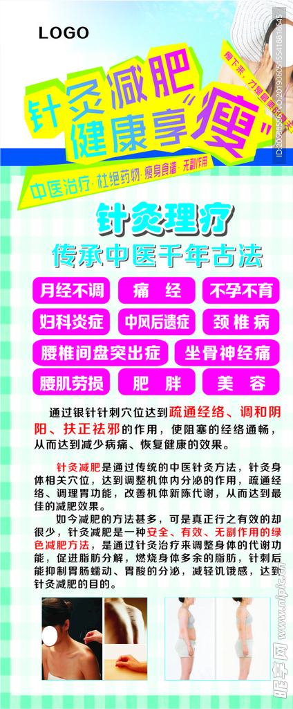 针灸减肥