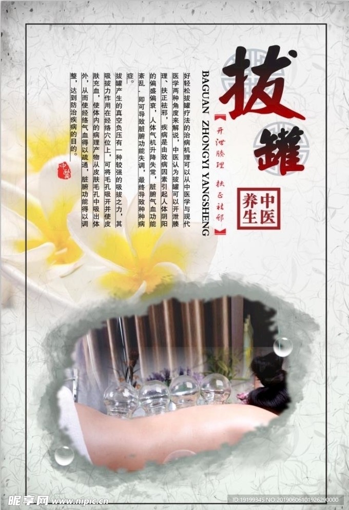 拔罐