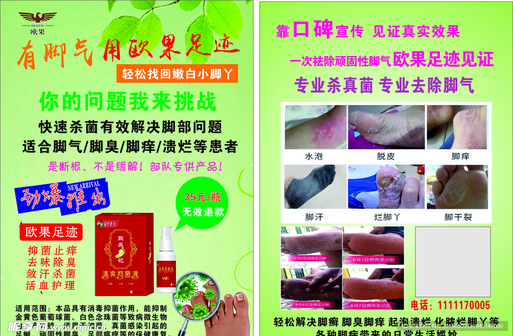 欧果脚气药