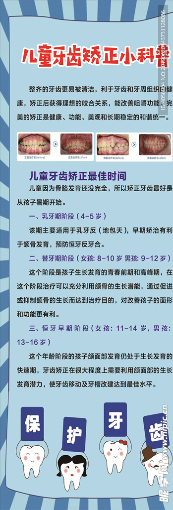 儿童牙齿矫正科普展架