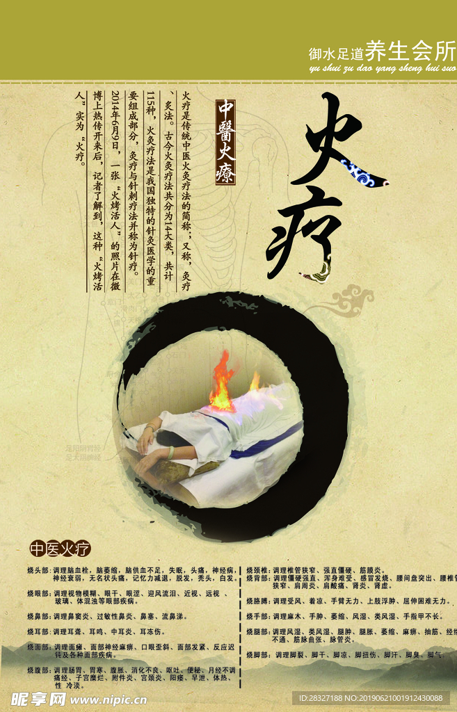 火疗