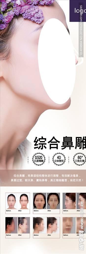 隆鼻展架