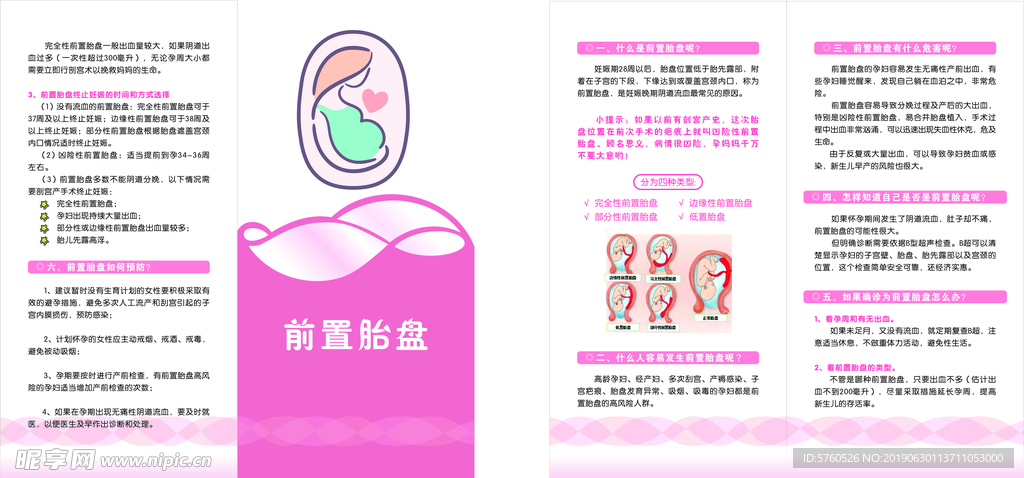 前置胎盘