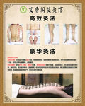 艾灸高效灸法