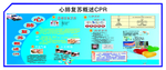 心肺复苏