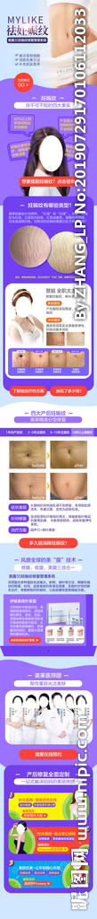 妊娠纹详情