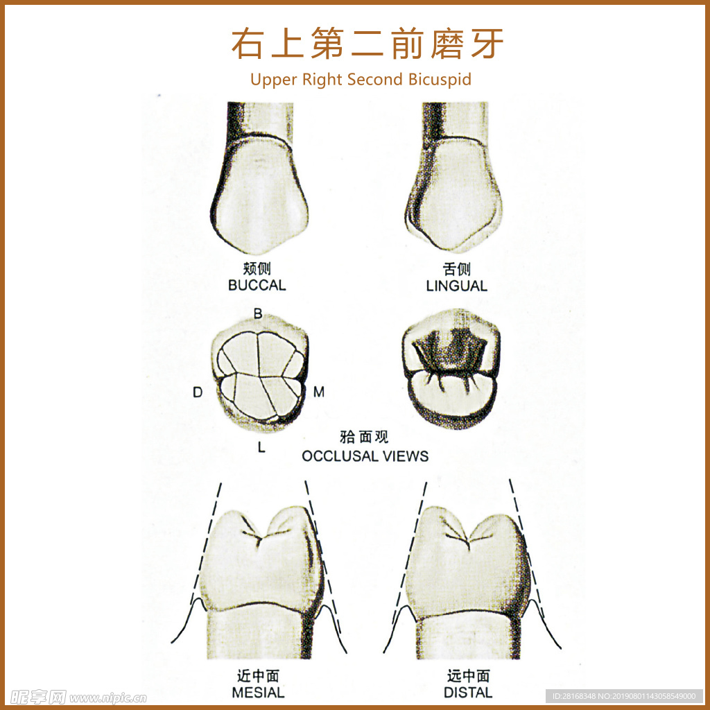 右上第二前磨牙