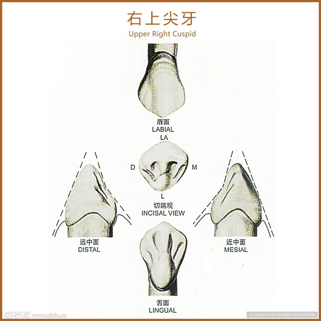 右上尖牙