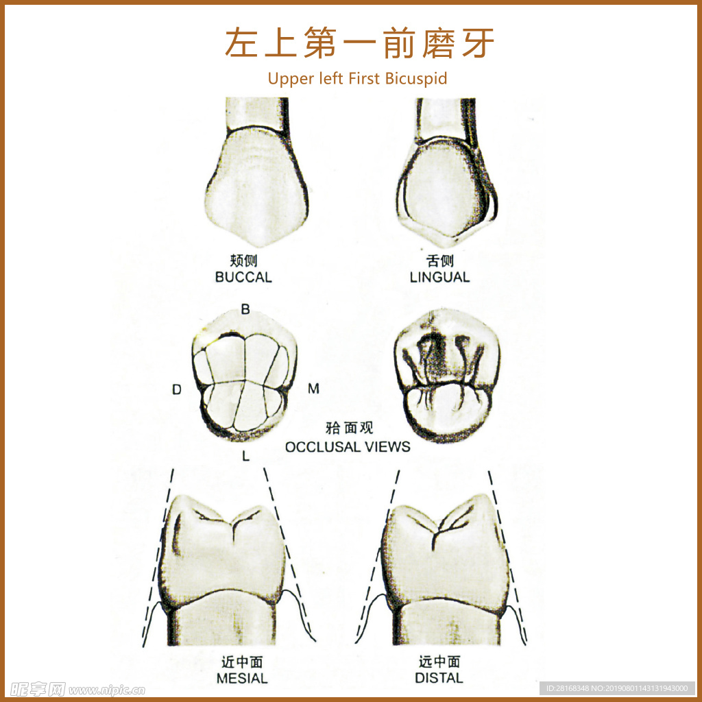 左上第一前磨牙