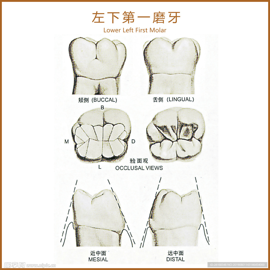 左下第一磨牙