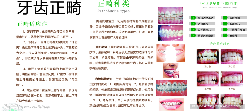 牙齿正畸