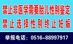 禁止性别鉴定 优生优育 禁止终