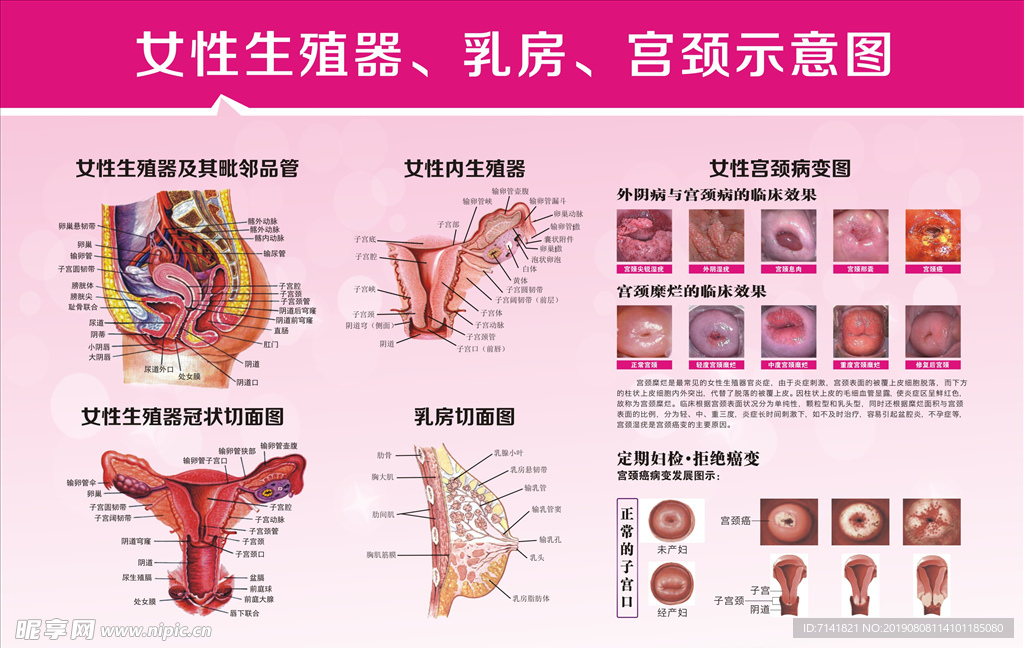 子宫图