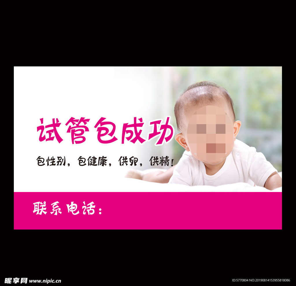 试管婴儿