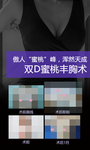 丰胸术案例对比