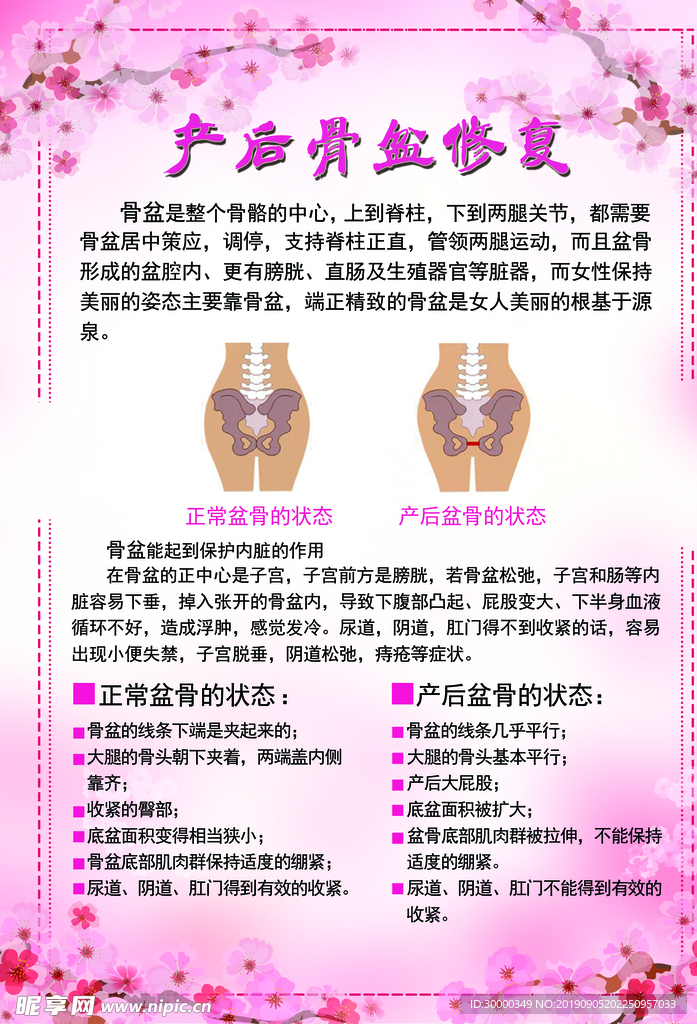 骨盆修复