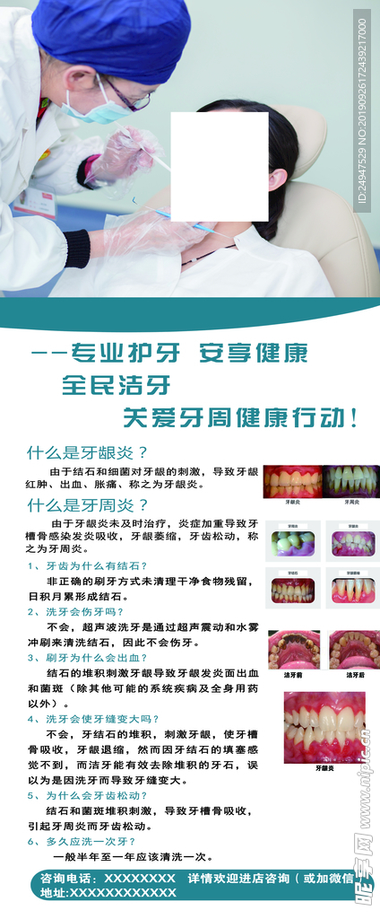 口腔展架