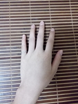 手
