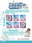 窝沟封闭预防龋齿