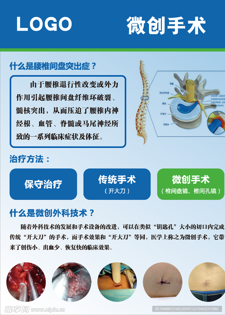 微创手术