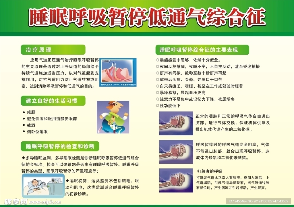 睡眠呼吸暂停低通气综合征