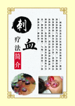 刺血