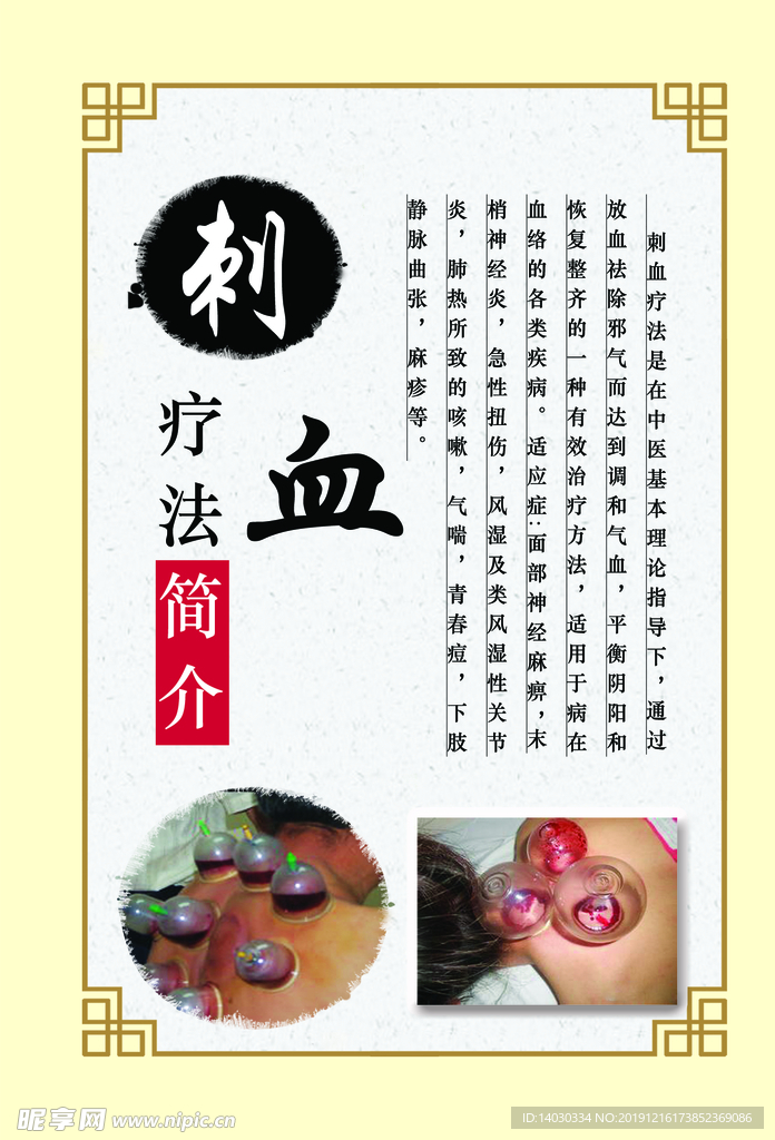 刺血