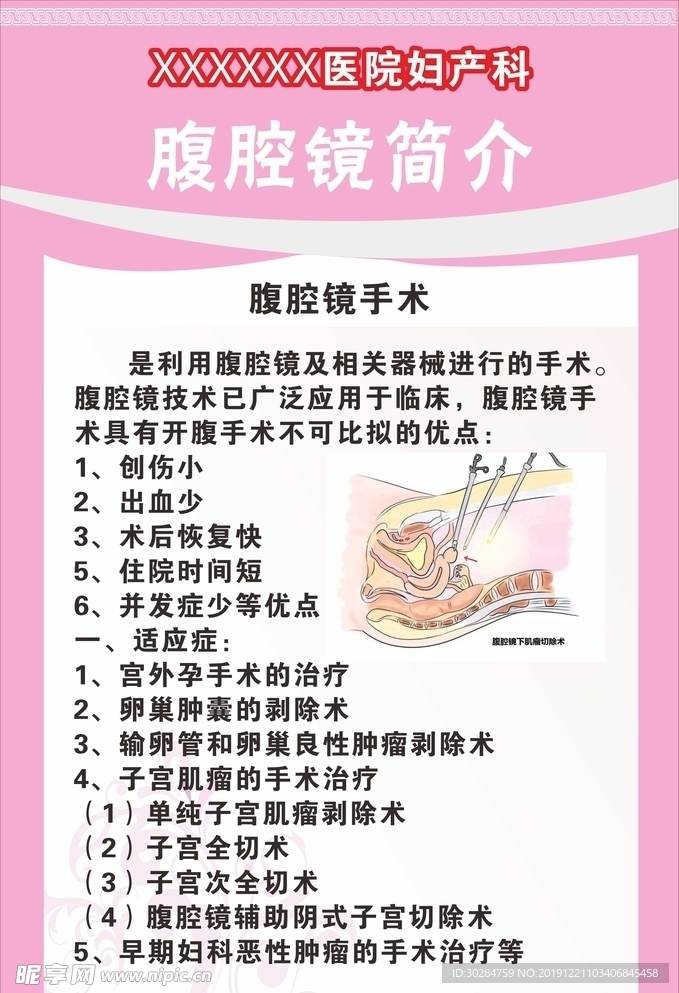 腹腔镜