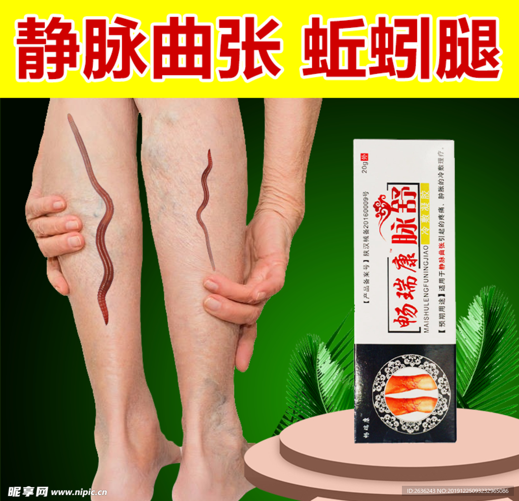 静脉曲张