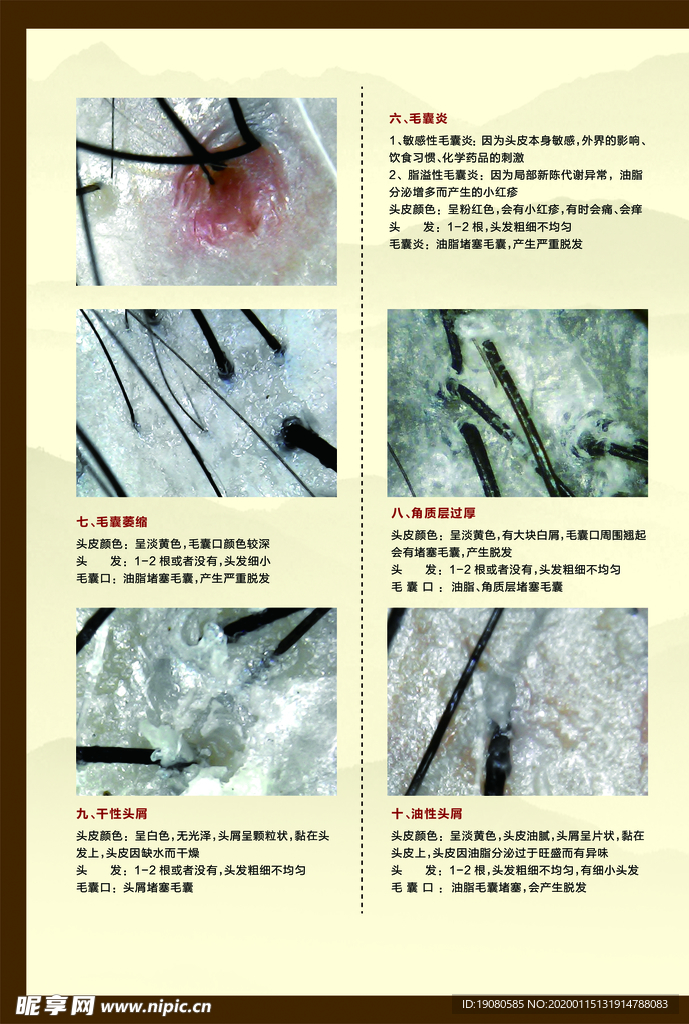 发质 毛囊 对比 分析