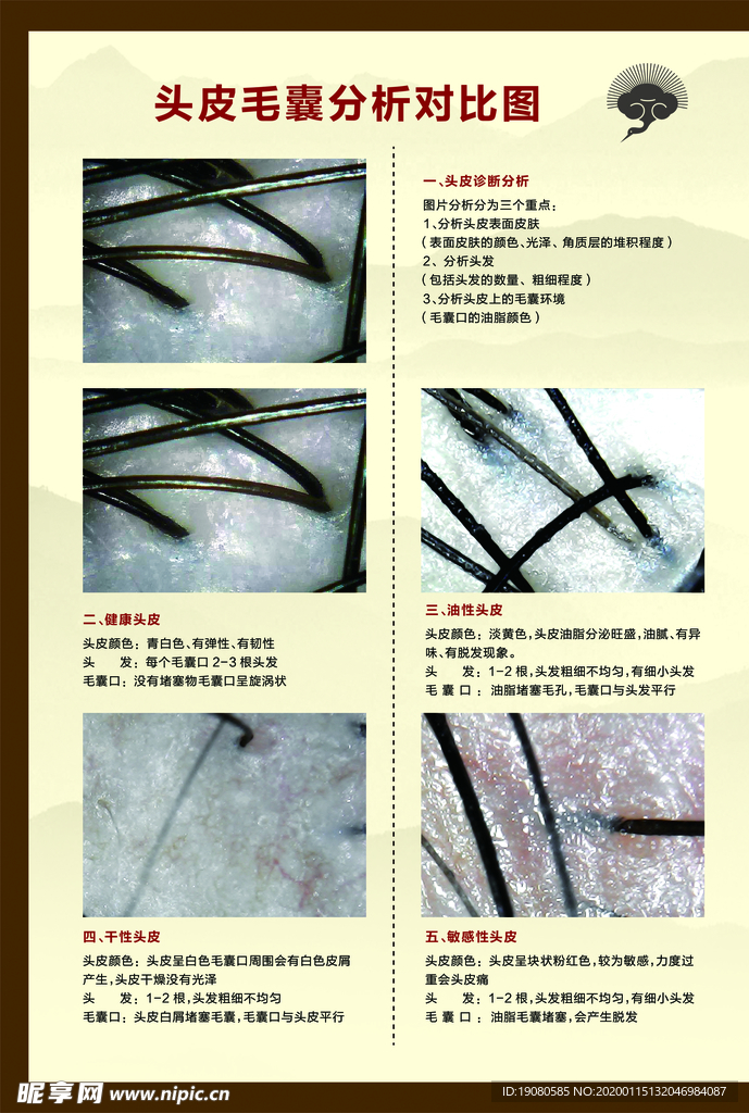 毛囊对比分析  发质对比