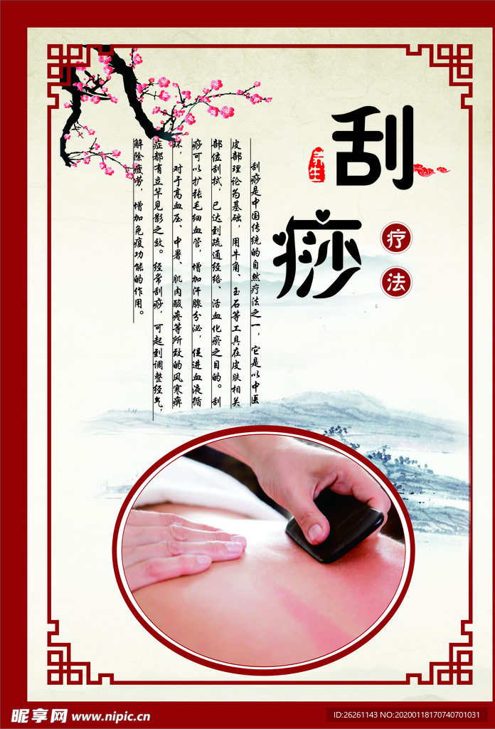 刮痧