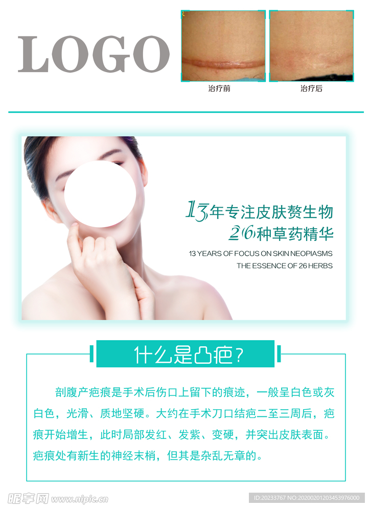凸疤