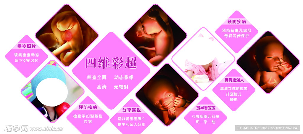 四维彩超