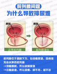 男科常识