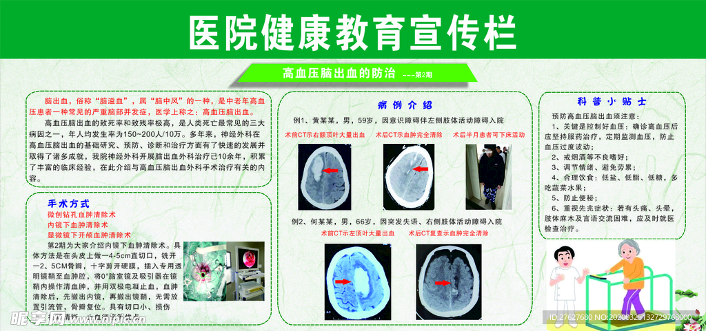 医院宣传栏 健康宣传栏