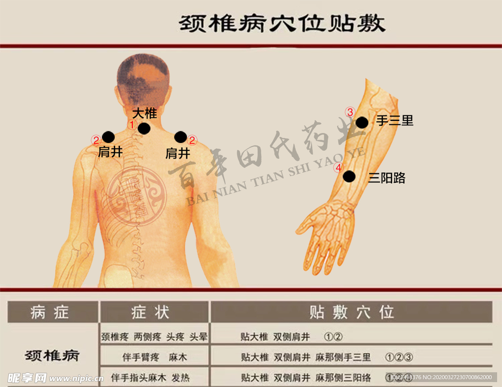 膏药穴位贴敷