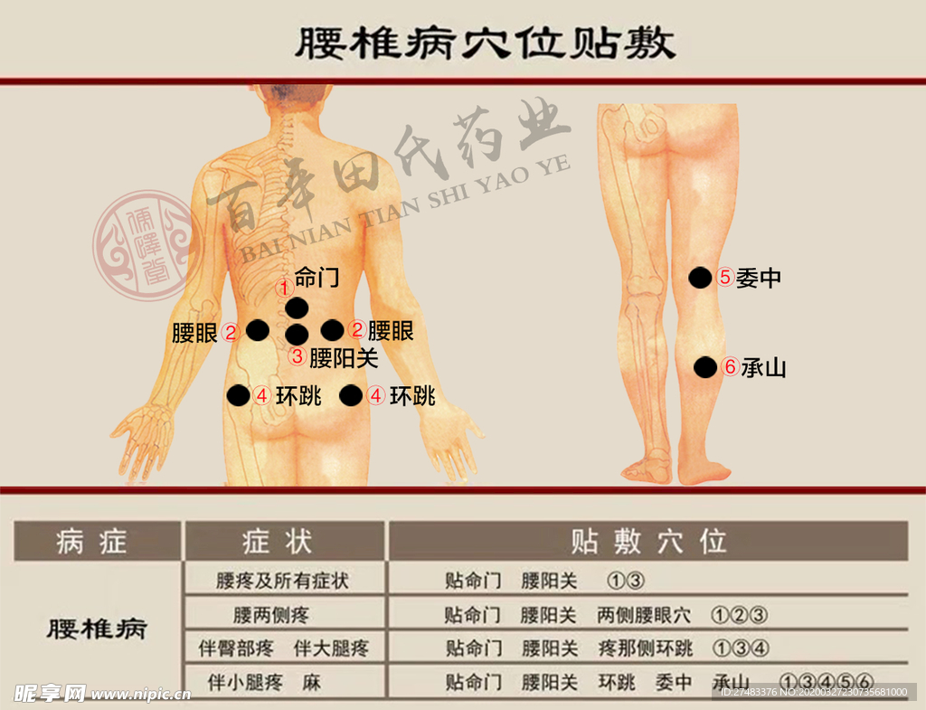 膏药贴敷