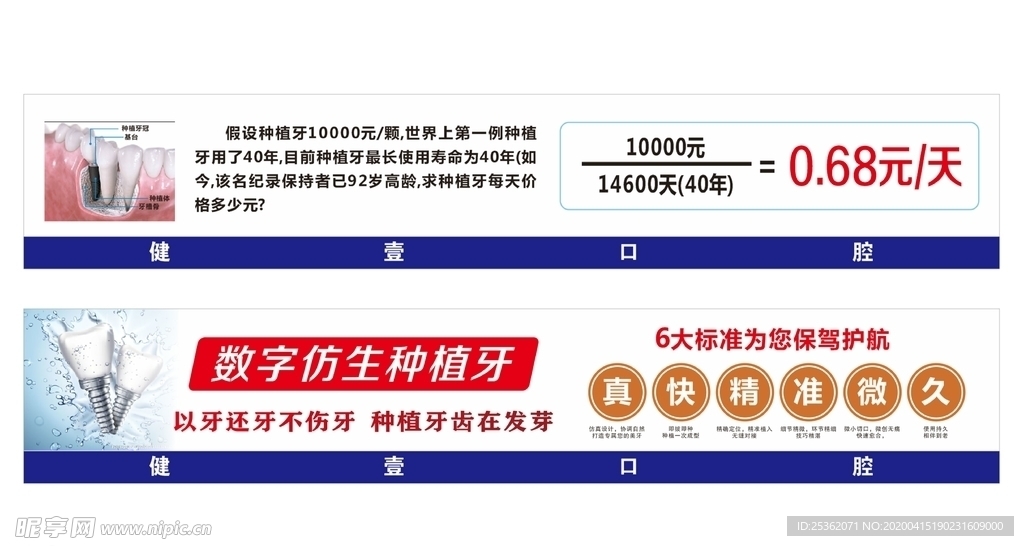 数字仿生种植牙