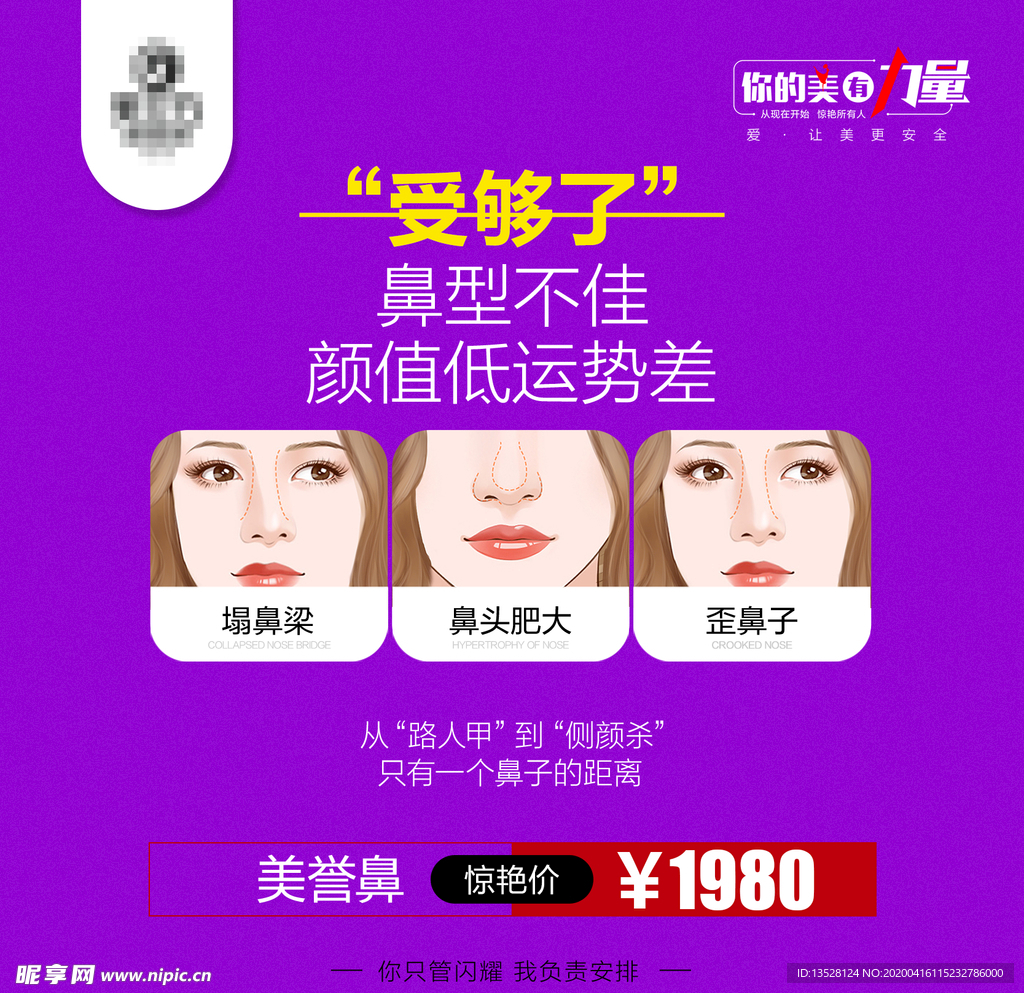 美誉鼻