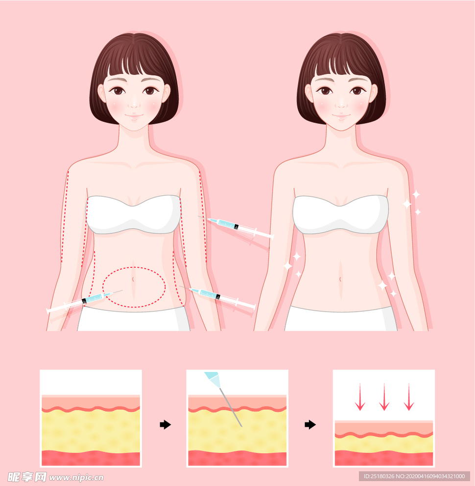 医美插画