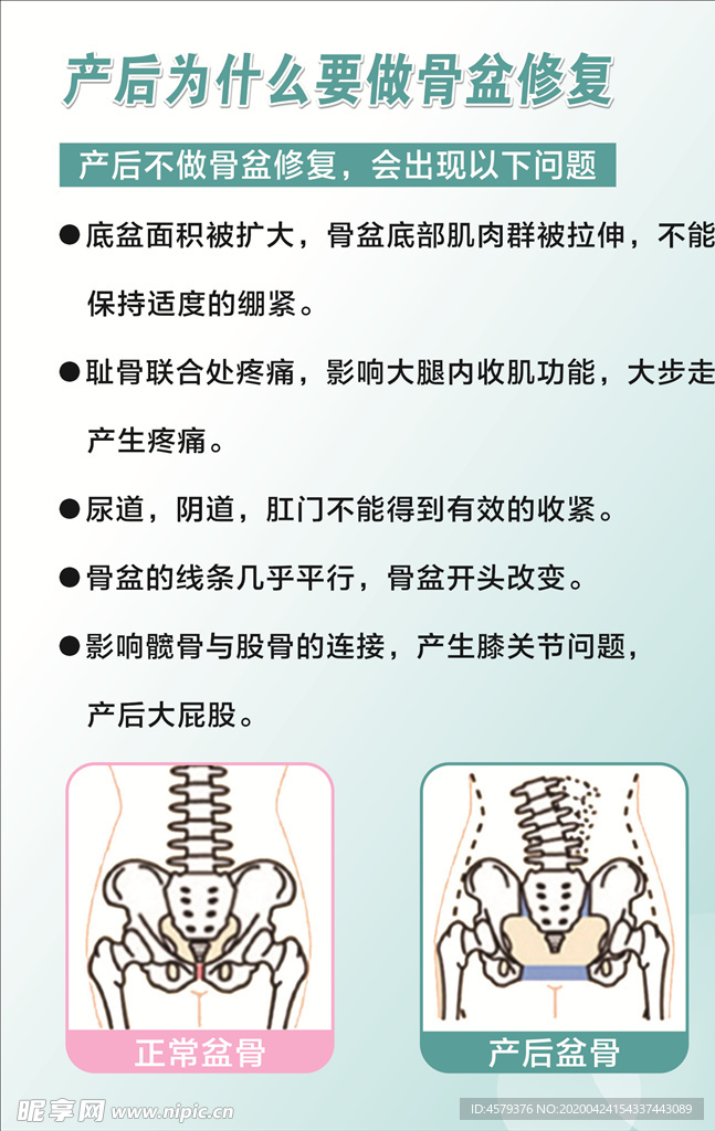 产后修复 产后