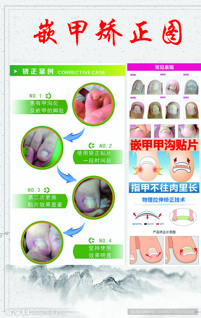 足疗