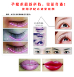 孕睫术