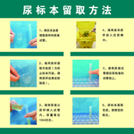 尿标本留取方法
