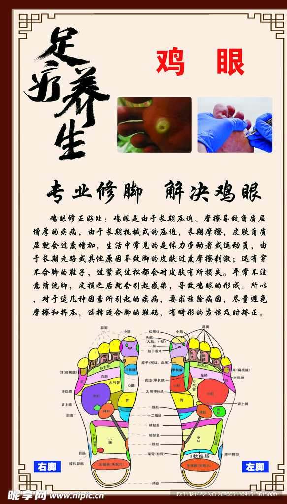 鸡眼