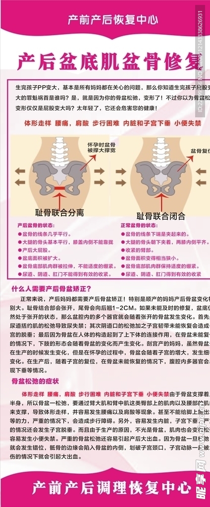 产后盆底股盆骨修复展架